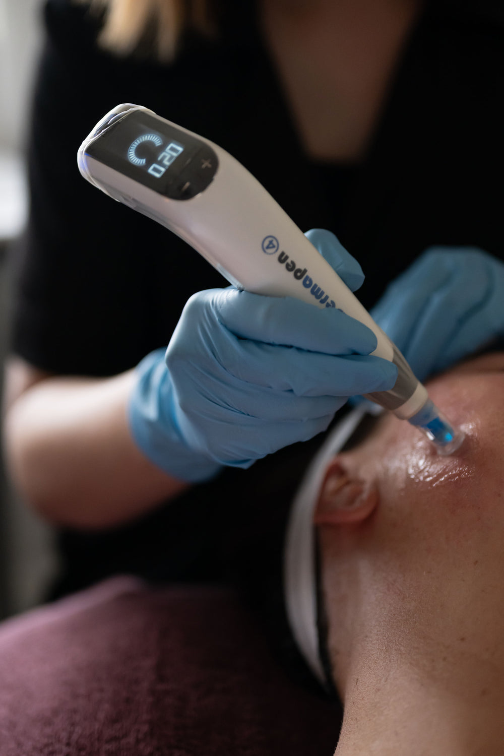 Advanced Skin Treatments